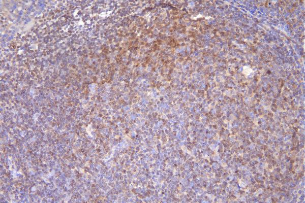 IHC - Anti-DCK Antibody Picoband™ (monoclonal, 3G10) ABO14895